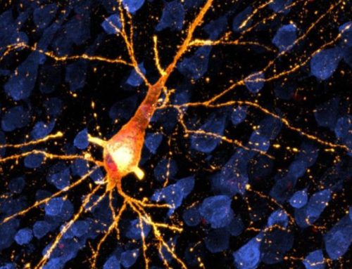 Exploring Early Stage Alzheimer’s Disease